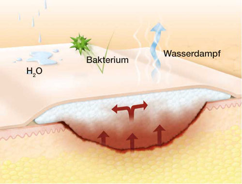 SUPRASORB P sensitive PU-Schaumv.non-bor.5x5cm